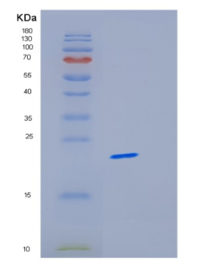 Recombinant Human ICT1 Protein,Recombinant Human ICT1 Protein