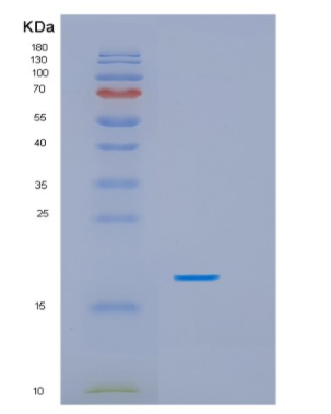 Recombinant Human HSPB9 Protein,Recombinant Human HSPB9 Protein