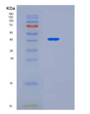 Recombinant Human HYKK Protein,Recombinant Human HYKK Protein