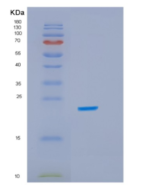 Recombinant E.coli idnk Protein,Recombinant E.coli idnk Protein