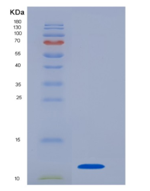 Recombinant Interleukin 8 (IL8),Recombinant Interleukin 8 (IL8)