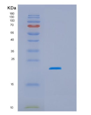 Recombinant Human HSPC159 Protein,Recombinant Human HSPC159 Protein