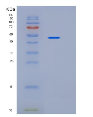 Recombinant Human ICOSLG Protein,Recombinant Human ICOSLG Protein