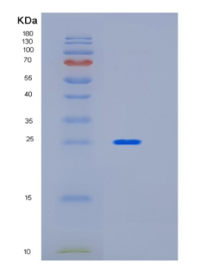 Recombinant Human ICAM2 Protein,Recombinant Human ICAM2 Protein