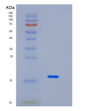 Recombinant Human ID2 Protein,Recombinant Human ID2 Protein