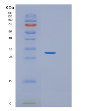 Recombinant Human IDI2 Protein,Recombinant Human IDI2 Protein