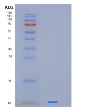 Recombinant Human IER3 Protein,Recombinant Human IER3 Protein