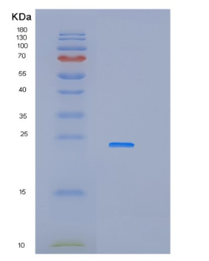 Recombinant Human IFNA14 Protein,Recombinant Human IFNA14 Protein