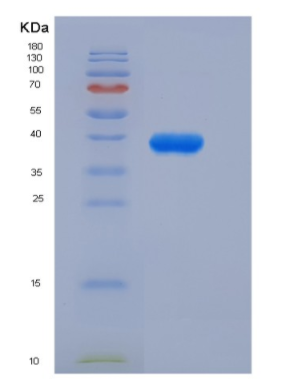 Recombinant Insulin Like Growth Factor 1 (IGF1),Recombinant Insulin Like Growth Factor 1 (IGF1)