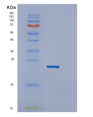 Recombinant Mouse Igfbp6 Protein,Recombinant Mouse Igfbp6 Protein