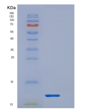 Recombinant Interleukin 1 Receptor Type I (IL1R1),Recombinant Interleukin 1 Receptor Type I (IL1R1)