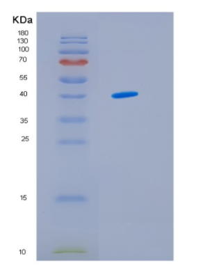 Recombinant Human IDH3G Protein,Recombinant Human IDH3G Protein