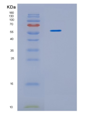 Recombinant Human IDS Protein,Recombinant c