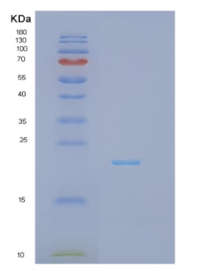 Recombinant Human IFNA7 Protein,Recombinant Human IFNA7 Protein