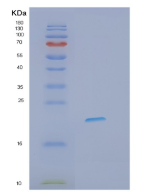 Recombinant Human IFNL3 Protein,Recombinant Human IFNL3 Protein