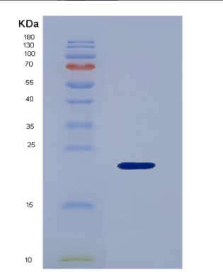 Recombinant Human IGFBP3 Protein,Recombinant Human IGFBP3 Protein