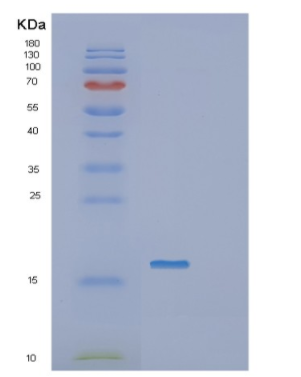 Recombinant Human IGJ Protein,Recombinant Human IGJ Protein