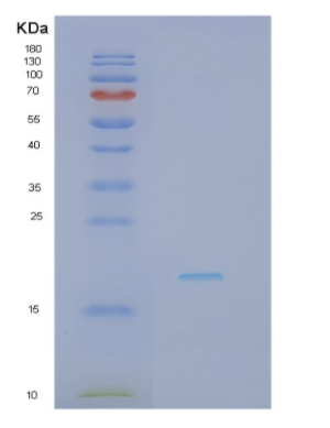 Recombinant Interleukin 18 (IL18),Recombinant Interleukin 18 (IL18)