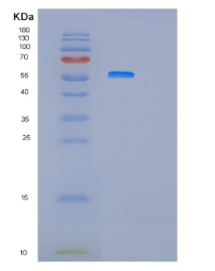 Recombinant Human IFIT3 Protein,Recombinant Human IFIT3 Protein