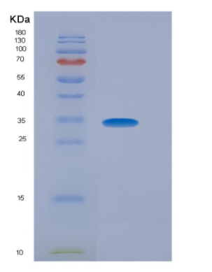 Eukaryotic Interleukin 29 (IL29),Eukaryotic Interleukin 29 (IL29)