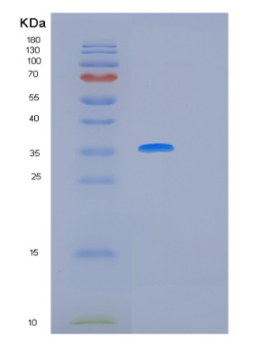 Recombinant Human IL12 Protein,Recombinant Human IL12 Protein