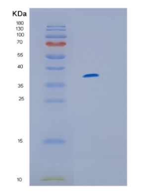Recombinant Human IL13RA1 Protein,Recombinant Human IL13RA1 Protein