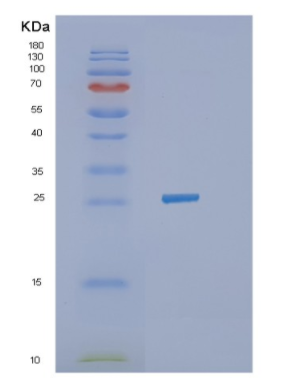 Recombinant Human IGFBP6 Protein,Recombinant Human IGFBP6 Protein