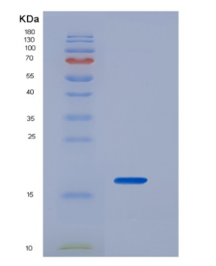 Recombinant Interleukin 2 (IL2),Recombinant Interleukin 2 (IL2)