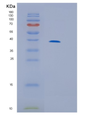 Recombinant Human IL13RA2 Protein,Recombinant Human IL13RA2 Protein