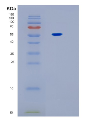 Recombinant Human IL17RB Protein,Recombinant Human IL17RB Protein