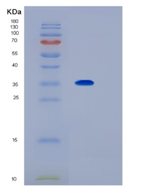 Recombinant Human IL1RL1 Protein,Recombinant Human IL1RL1 Protein