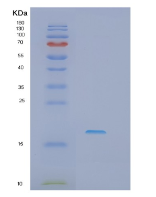 Recombinant Human IFT20 Protein,Recombinant Human IFT20 Protein