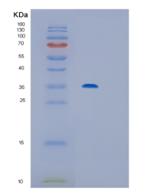 Recombinant Human IL12P40 Protein,Recombinant Human IL12P40 Protein