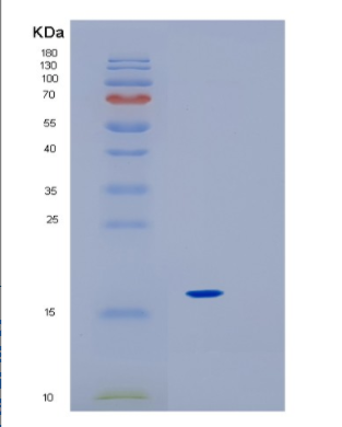 Recombinant Mouse IL18 Protein,Recombinant Mouse IL18 Protein