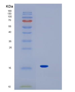 Recombinant Human IL1F10 Protein,Recombinant Human IL1F10 Protein