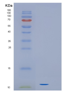 Recombinant Human IL16 Protein,Recombinant Human IL16 Protein
