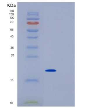 Recombinant Rat IL1rn Protein,Recombinant Rat IL1rn Protein