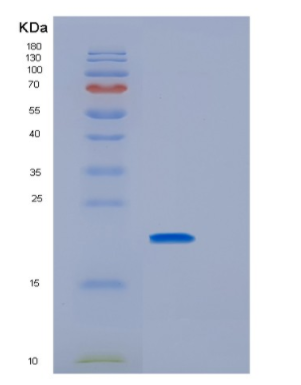 Recombinant Rat Il33 Protein,Recombinant Rat Il33 Protein