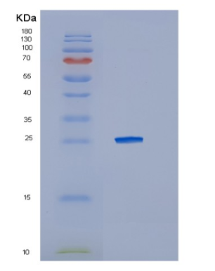 Recombinant Human IL10RA Protein,Recombinant Human IL10RA Protein