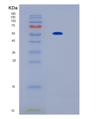 Recombinant Mouse Il17rb Protein,Recombinant Mouse Il17rb Protein