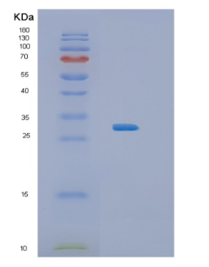 Recombinant Human IL34 Protein,Recombinant Human IL34 Protein