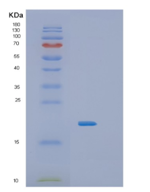 Recombinant Human IL36RN Protein,Recombinant Human IL36RN Protein