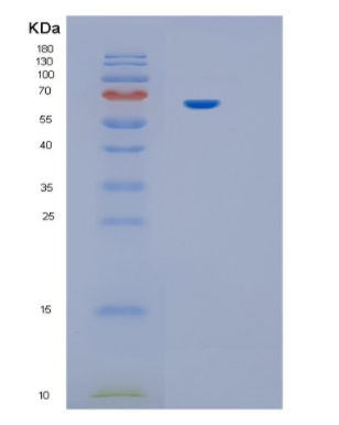 Recombinant Human IL12RB1 Protein,Recombinant Human IL12RB1 Protein