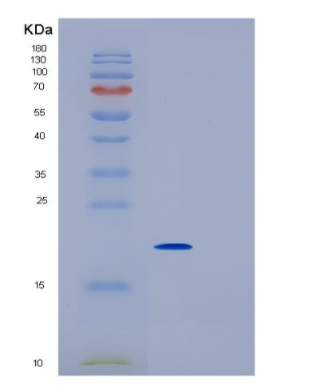 Recombinant Mouse IL1RN Protein,Recombinant Mouse IL1RN Protein