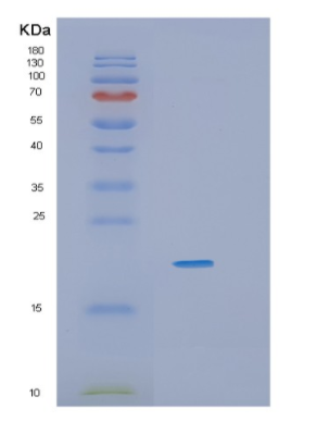 Recombinant Human IL36G Protein,Recombinant Human IL36G Protein