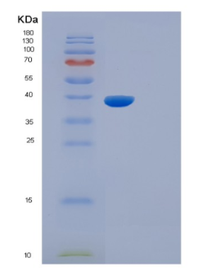 Recombinant Mouse Il5ra Protein,Recombinant Mouse Il5ra Protein