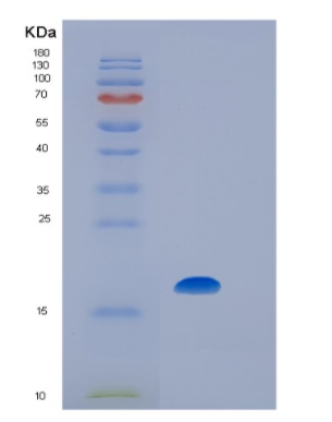 Recombinant Human IL7 Protein,Recombinant Human IL7 Protein