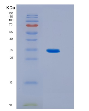 Recombinant Human IL23 Protein,Recombinant Human IL23 Protein