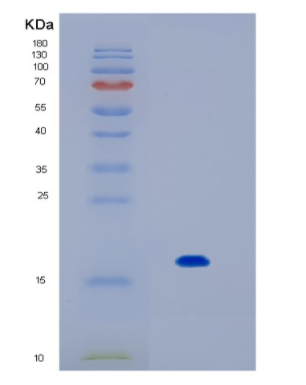 Recombinant Human IL17F Protein,Recombinant Human IL17F Protein