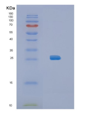 Recombinant Mouse IL34 Protein,Recombinant Mouse IL34 Protein